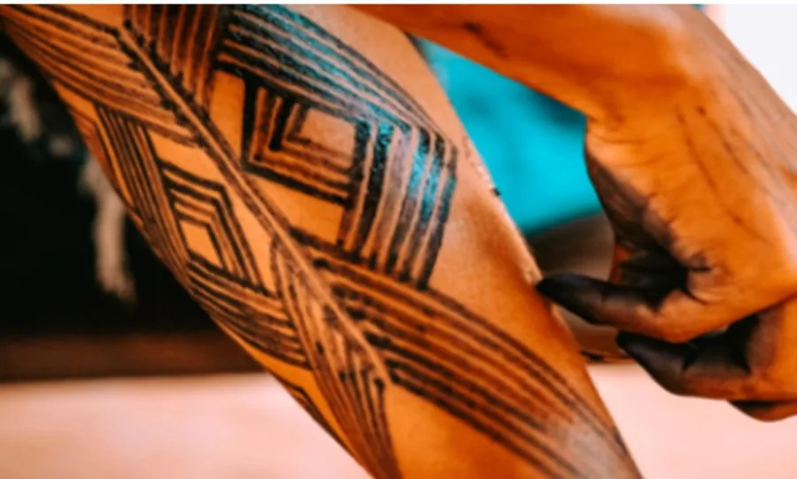 Eliminación de tatuajes con láser
