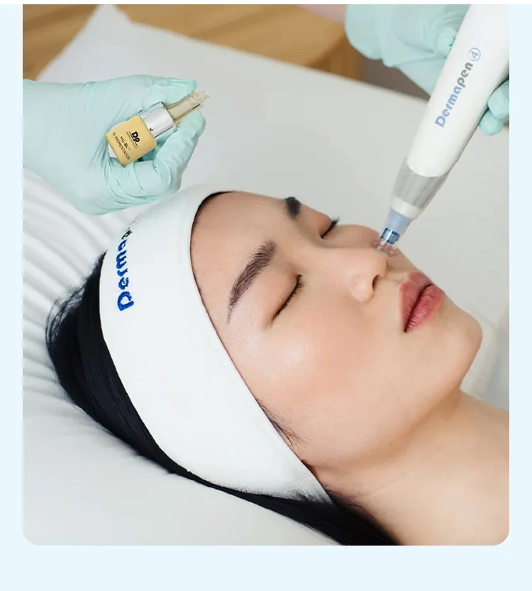 Tratamiento de microagujas con Dermapen 4