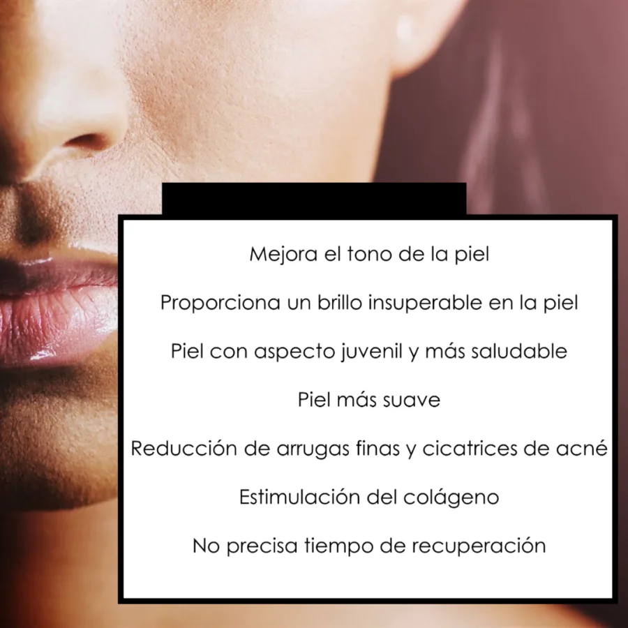 Peeling de carbono alta gama con láser