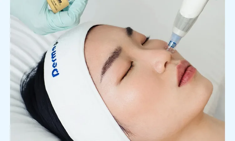 Tratamiento de microagujas con Dermapen 4